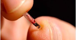 микрочипы под кожу