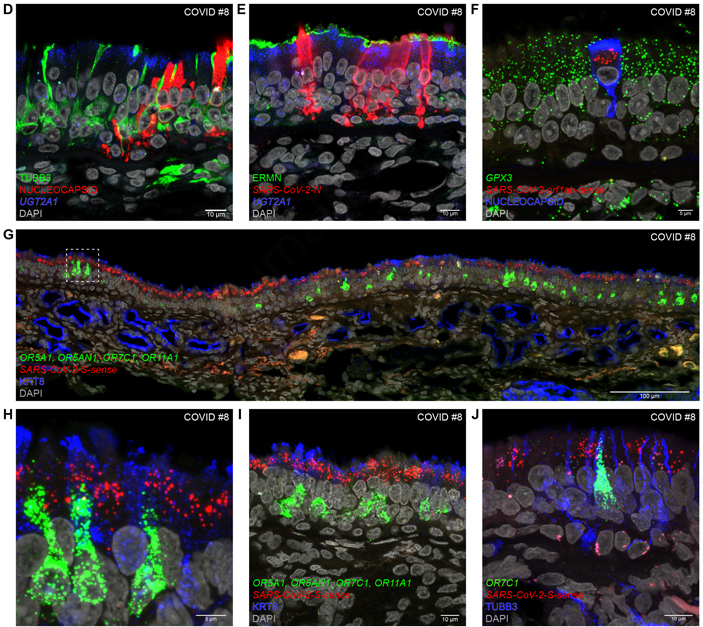 SARS-CoV-2 поражает не нейроны, а поддерживающие клетки обонятельного эпителия