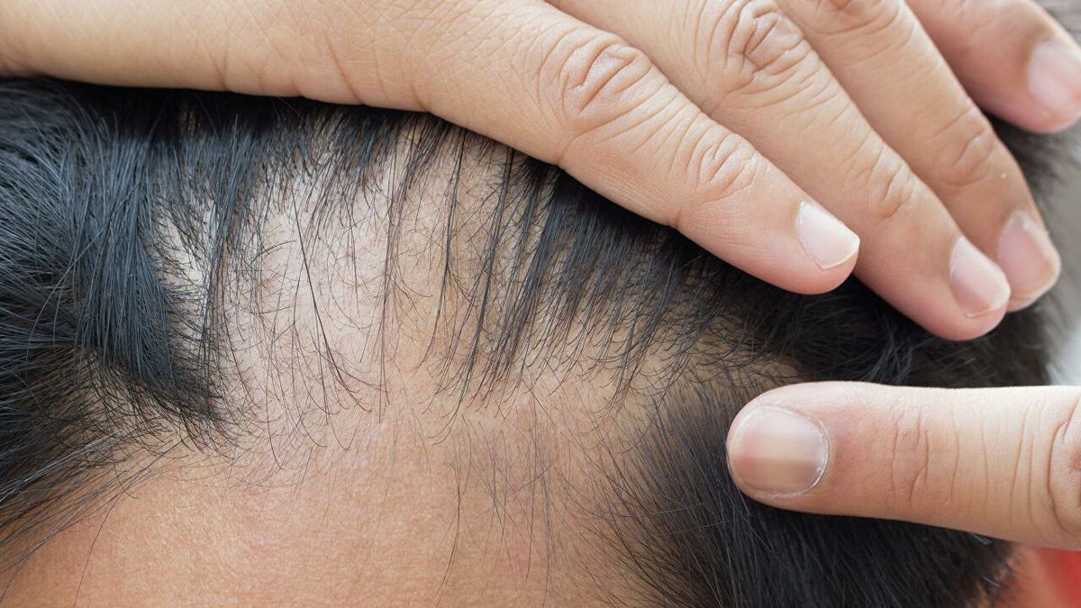 Ученые расшифровали тайну поседения волос